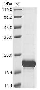 Greater than 85% as determined by SDS-PAGE.Recombinant Human T Cell Receptor Beta Constant 2 (TRBC2) Protein (His&Myc)