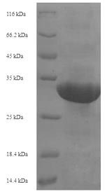 Greater than 90% as determined by SDS-PAGE.Recombinant Human Transcription Intermediary Factor 1-Alpha (TRIM24) Protein (His-SUMO)
