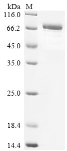 Greater than 85% as determined by SDS-PAGE.Recombinant Mouse 60 Kda Ss-A/Ro Ribonucleoprotein (TROVE2) Protein (His-SUMO&Myc)