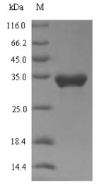 Greater than 90% as determined by SDS-PAGE.Recombinant Human Transient Receptor Potential Cation Channel Subfamily A Member 1 (TRPA1) Protein (His-SUMO)