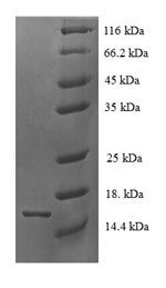 Greater than 90% as determined by SDS-PAGE.Recombinant Human Tetraspanin-7 (TSPAN7) Protein (His)