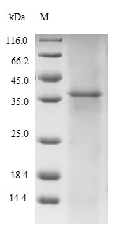 Greater than 85% as determined by SDS-PAGE.Recombinant Human Titin (TTN) Protein (His&Myc)