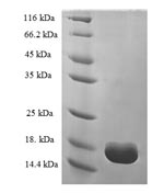 Greater than 90% as determined by SDS-PAGE.Recombinant Human Transthyretin (TTR) Protein (His)