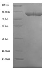 Greater than 90% as determined by SDS-PAGE.Recombinant Human Elongation Factor Tu, Mitochondrial (TUFM) Protein (His-SUMO)