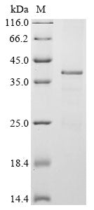 Greater than 85% as determined by SDS-PAGE.Recombinant Mouse Twist-Related Protein 1 (TWIST1) Protein (His-KSI)