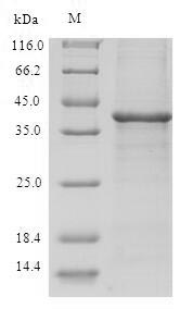 Greater than 90% as determined by SDS-PAGE.Recombinant Human Thioredoxin Domain-Containing Protein 17 (TXNDC17) Protein (GST)