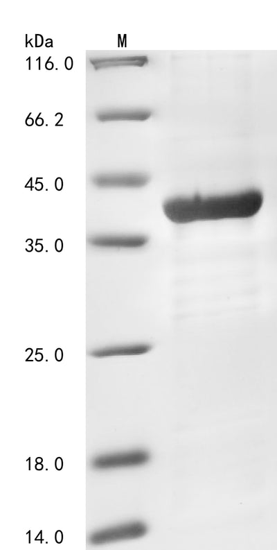 Greater than 85% as determined by SDS-PAGE.Recombinant Human Non-Receptor Tyrosine-Protein Kinase Tyk2 (TYK2) Protein (His)