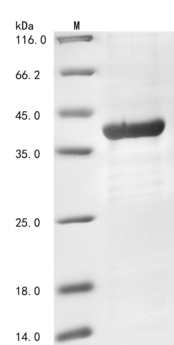 Greater than 85% as determined by SDS-PAGE.Recombinant Human Non-Receptor Tyrosine-Protein Kinase Tyk2 (TYK2) Protein (His)