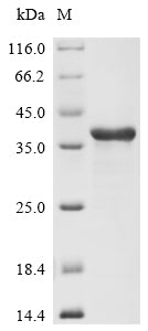 Greater than 90% as determined by SDS-PAGE.Recombinant Human Non-Receptor Tyrosine-Protein Kinase Tyk2 (TYK2) Protein (His)