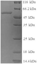 Greater than 90% as determined by SDS-PAGE.Recombinant Human Tyrosinase (TYR) Protein (His-SUMO)