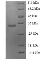 Greater than 90% as determined by SDS-PAGE.Recombinant Human Ubiquitin-Conjugating Enzyme E2 Variant 2 (UBE2V2) Protein (His-SUMO)