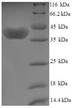 Greater than 90% as determined by SDS-PAGE.Recombinant Human Uridine-Cytidine Kinase 1 (UCK1) Protein (His-SUMO)