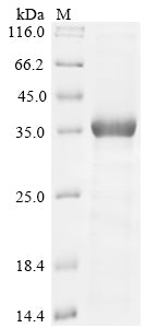 Greater than 85% as determined by SDS-PAGE.Recombinant Human Ubiquitin Carboxyl-Terminal Hydrolase 6 (USP6) Protein (His-KSI)