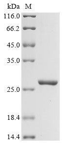 Greater than 90% as determined by SDS-PAGE.Recombinant Human Lysine-Specific Demethylase 6A (KDM6A) Protein (His&Myc)