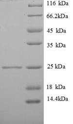 Greater than 90% as determined by SDS-PAGE.
