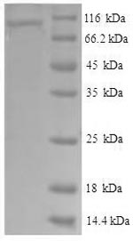 Greater than 90% as determined by SDS-PAGE.Recombinant Human Vascular Cell Adhesion Protein 1 (VCAM1) Protein (His-SUMO)
