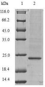 Greater than 90% as determined by SDS-PAGE.