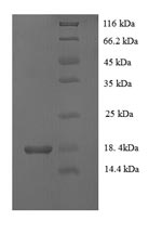 Greater than 90% as determined by SDS-PAGE.Recombinant Mouse Vascular Endothelial Growth Factor C (VEGFC) Protein (His)