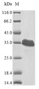 Greater than 85% as determined by SDS-PAGE.Recombinant Human Von Hippel-Lindau Disease Tumor Suppressor (VHL) Protein (His)