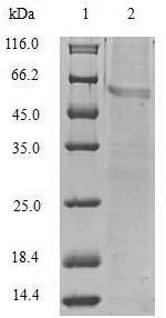 Greater than 90% as determined by SDS-PAGE.Recombinant Human Vimentin (VIM) Protein (His)