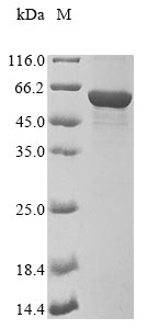 Greater than 85% as determined by SDS-PAGE.Recombinant Mouse Vimentin (VIM) Protein (His&Myc)
