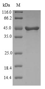 Greater than 90% as determined by SDS-PAGE.Recombinant Human Visinin-Like Protein 1 (VSNL1) Protein (GST)
