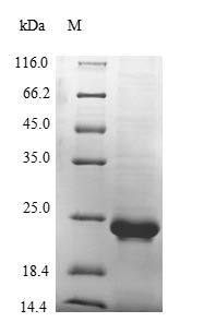Greater than 85% as determined by SDS-PAGE.Recombinant Mouse Von Willebrand Factor (VWF) Protein (His&Myc)