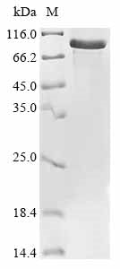 Greater than 85% as determined by SDS-PAGE.Recombinant Human Wee1-Like Protein Kinase (WEE1) Protein (His)