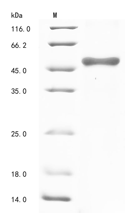Greater than 90% as determined by SDS-PAGE.Recombinant Human Proto-Oncogene Wnt-1 (WNT1) Protein (His-GST&Myc)