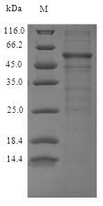 Greater than 90% as determined by SDS-PAGE.Recombinant Human Protein Wnt-5Aï¼ˆWnt5Aï¼‰ (WNT5A) Protein (His-SUMO&myc)