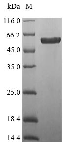 Greater than 85% as determined by SDS-PAGE.Recombinant Mouse Protein Wnt-7B (WNT7B) Protein (His-SUMO&Myc)