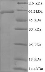Greater than 90% as determined by SDS-PAGE.Recombinant Human Wilms Tumor Protein (WT1) Protein (His-SUMO)