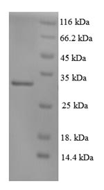 Greater than 90% as determined by SDS-PAGE.Recombinant Human Dna Repair Protein Complementing Xp-C Cells (XPC) Protein (His)