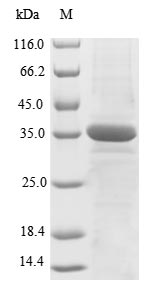 Greater than 85% as determined by SDS-PAGE.Recombinant Human X-Ray Repair Cross-Complementing Protein 5 (XRCC5) Protein (His&Myc)