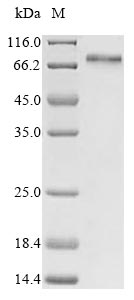 Greater than 85% as determined by SDS-PAGE.Recombinant Human Transcriptional Coactivator Yap1 (YAP1) Protein (His-B2M)
