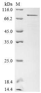 Greater than 85% as determined by SDS-PAGE.Recombinant Human Transcriptional Coactivator Yap1 (YAP1) Protein (His)