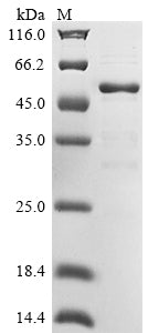 Greater than 85% as determined by SDS-PAGE.Recombinant Human Yjef N-Terminal Domain-Containing Protein 3 (YJEFN3)