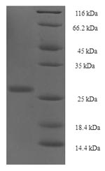 Greater than 90% as determined by SDS-PAGE.