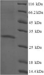 Greater than 90% as determined by SDS-PAGE.Recombinant Human Protein Yippee-Like 3 (YPEL3) Protein (His-SUMO)