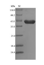 Greater than 90% as determined by SDS-PAGE.Recombinant Mouse 14-3-3 Protein Zeta/Delta (YWHAZ) Protein (His-SUMO)