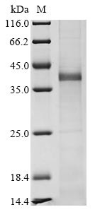 Greater than 85% as determined by SDS-PAGE.Recombinant Human Zinc Finger Protein Zic 2 (ZIC2) Protein (His)