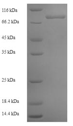 Greater than 90% as determined by SDS-PAGE.Recombinant Human Zinc Finger Protein 155 (ZNF155) Protein (His-SUMO)
