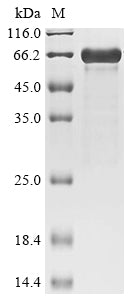 Greater than 85% as determined by SDS-PAGE.Recombinant Mouse Zinc Finger Protein 410 (ZNF410) Protein (His&Myc)