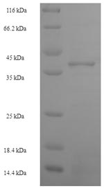 Greater than 90% as determined by SDS-PAGE.Recombinant Human Zinc Finger Protein 581 (ZNF581) Protein (His-SUMO)