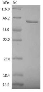 Greater than 90% as determined by SDS-PAGE.Recombinant Human Zona Pellucida Sperm-Binding Protein 3 (ZP3) Protein (His-SUMO)