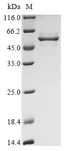 Greater than 90% as determined by SDS-PAGE.Recombinant Infectious Bronchitis Virus Spike Glycoprotein S1 Subunit (S1) Protein (His-B2M)