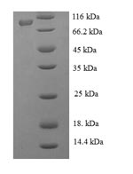 Greater than 90% as determined by SDS-PAGE.Recombinant Japanese Encephalitis Virus Genome Polyprotein (NS5) Protein (His-SUMO)