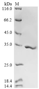 Greater than 90% as determined by SDS-PAGE.Recombinant Human Cytomegalovirus Enhanced Green Fluorescent Protein (EGFP) Protein (His)