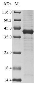 Greater than 85% as determined by SDS-PAGE.Recombinant Human Mig7 (MIG7) Protein (His-SUMO)