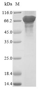 Greater than 85% as determined by SDS-PAGE.Recombinant Saccharomyces Cerevisiae Acetyl-Coa Carboxylase (ACC1) Protein (His)